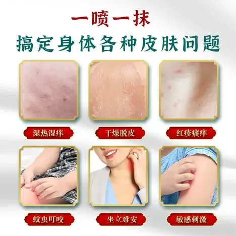 2 Pcs Herbal Antibacterial and anti-itch spray for skin Foot -30ml