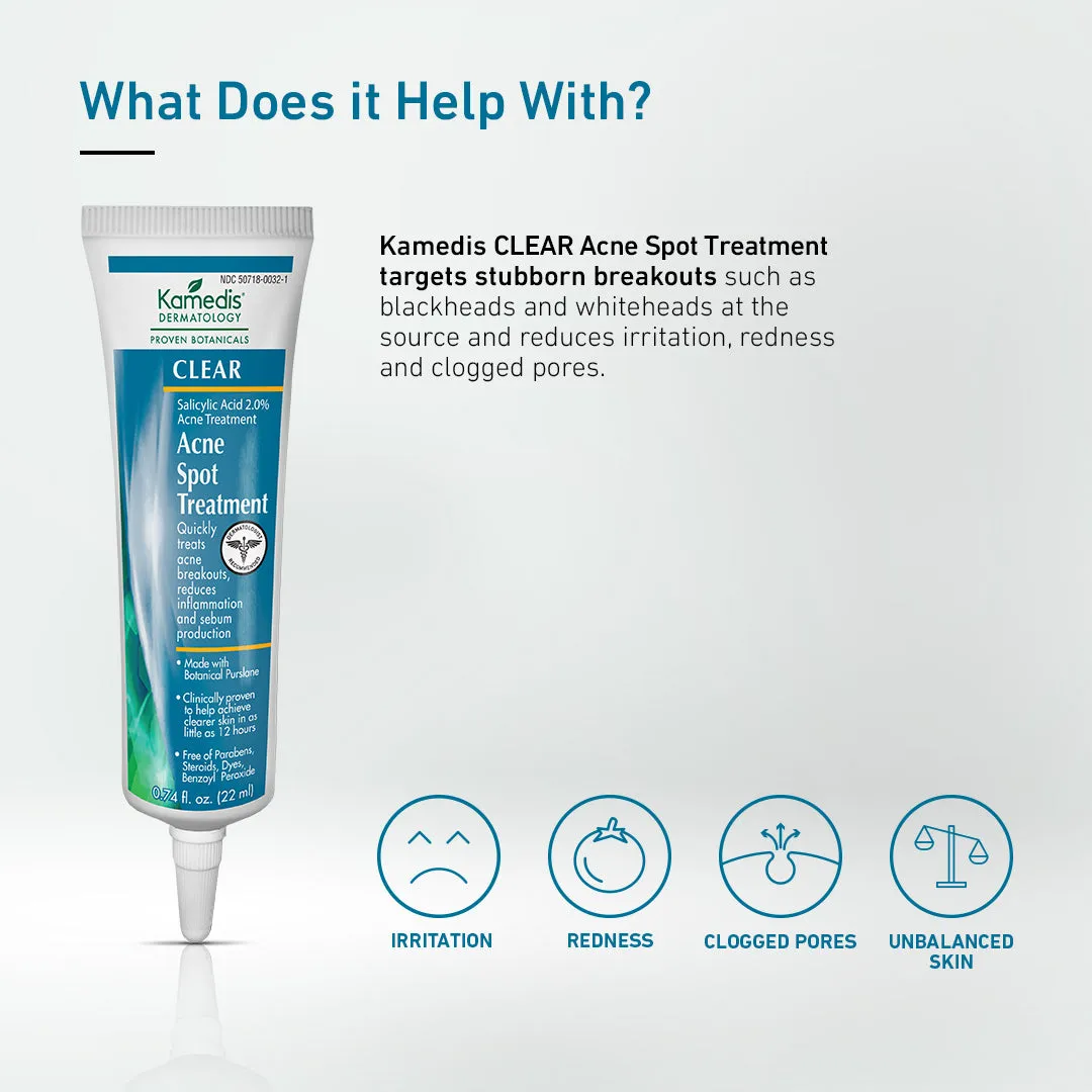 Acne Spot Treatment