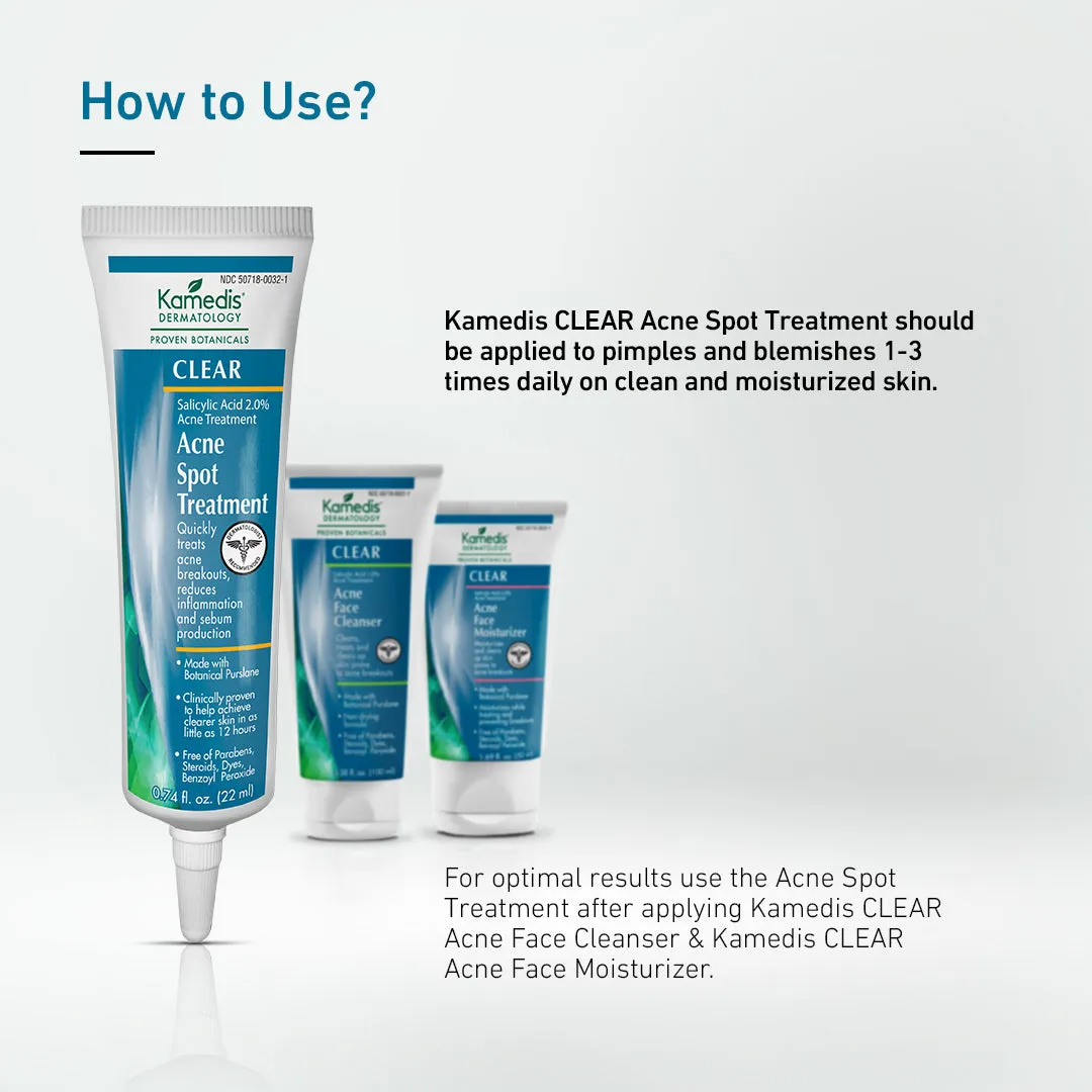 Acne Spot Treatment