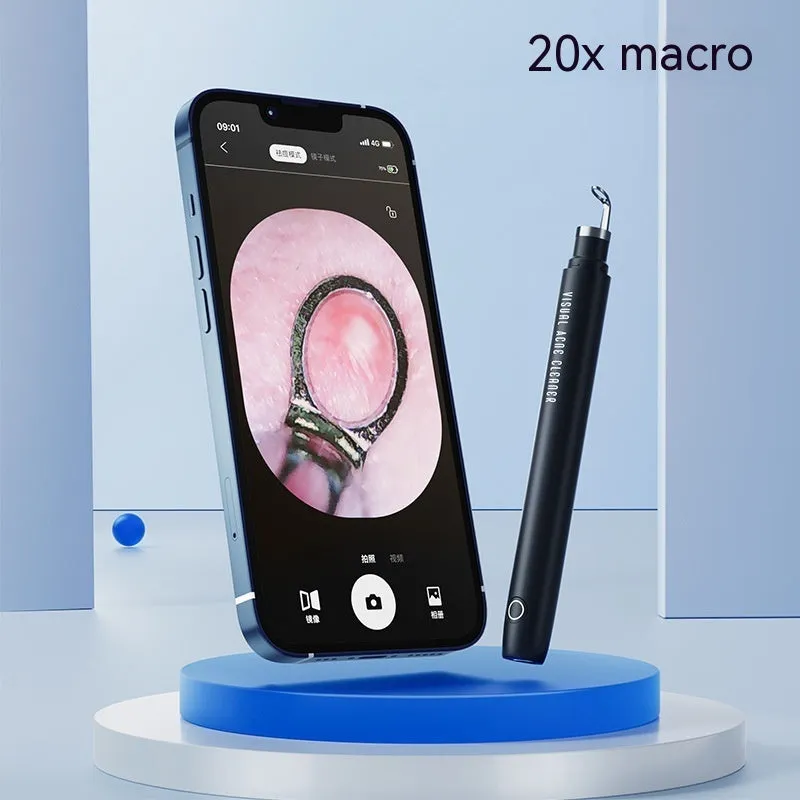 Acne Treatment Needle