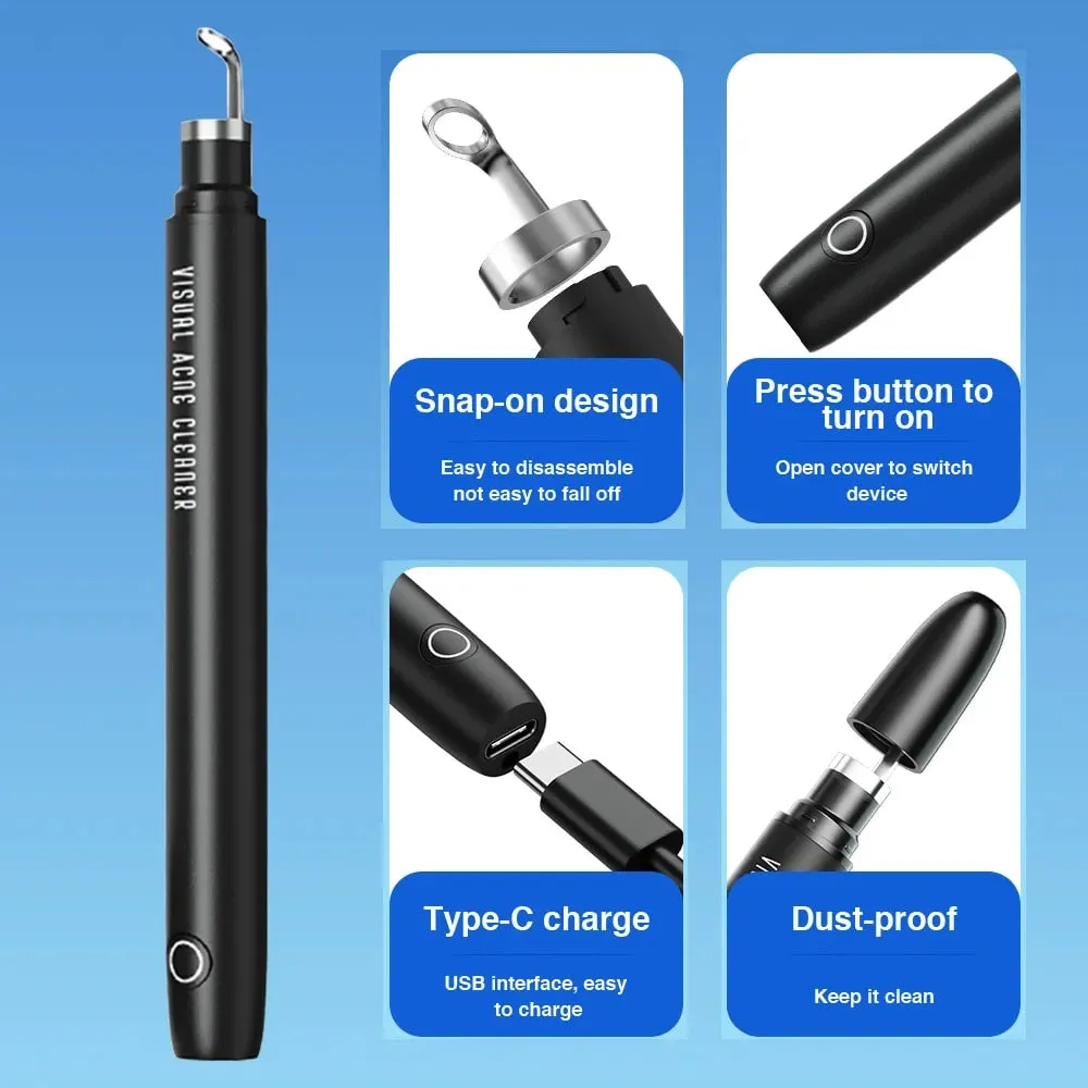 Acne Treatment Needle