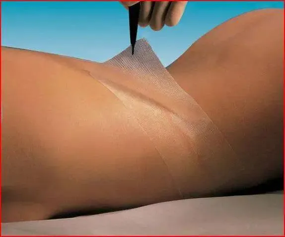 Adaptic Oil Emulsion Impregnated Dressing 3 inch x 16 inch (Each)
