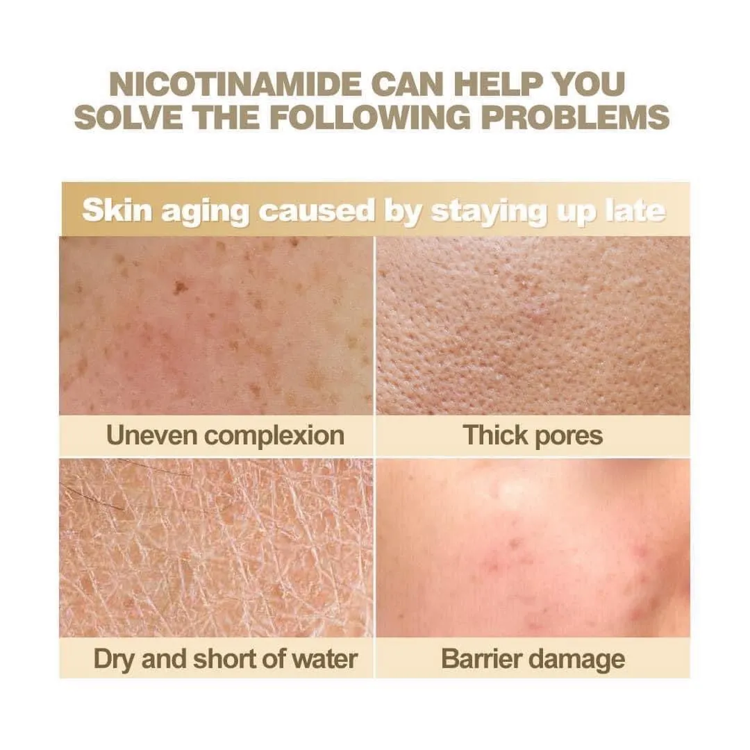 ASHLEY - NIACINAMIDE PURE SERUM 520 ML