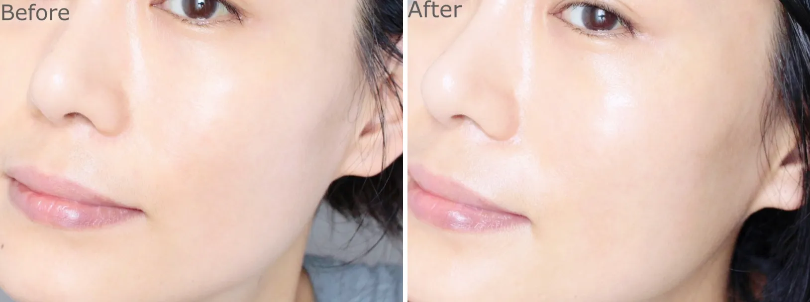 Azulene Relief Solution Ampoule 50mL Retail $110