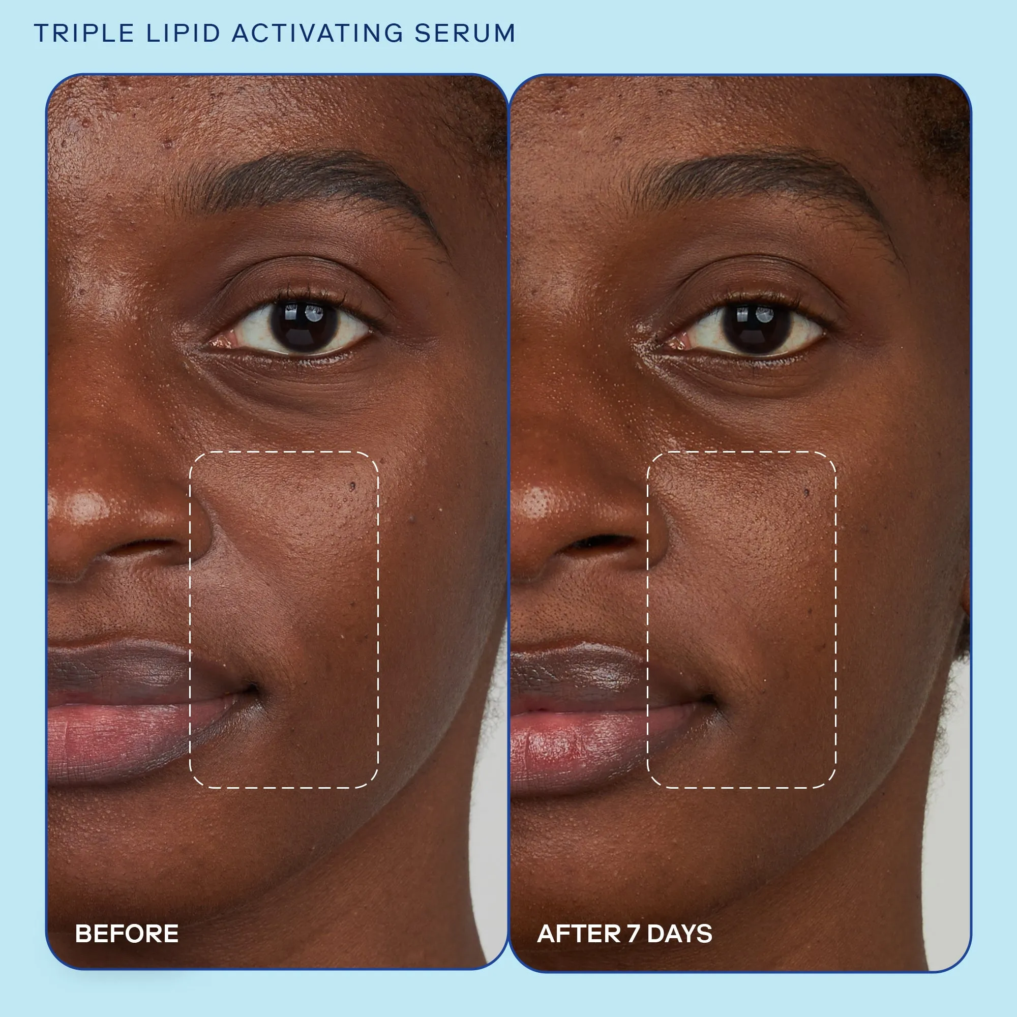 Barrier  Triple Lipid Activating Serum