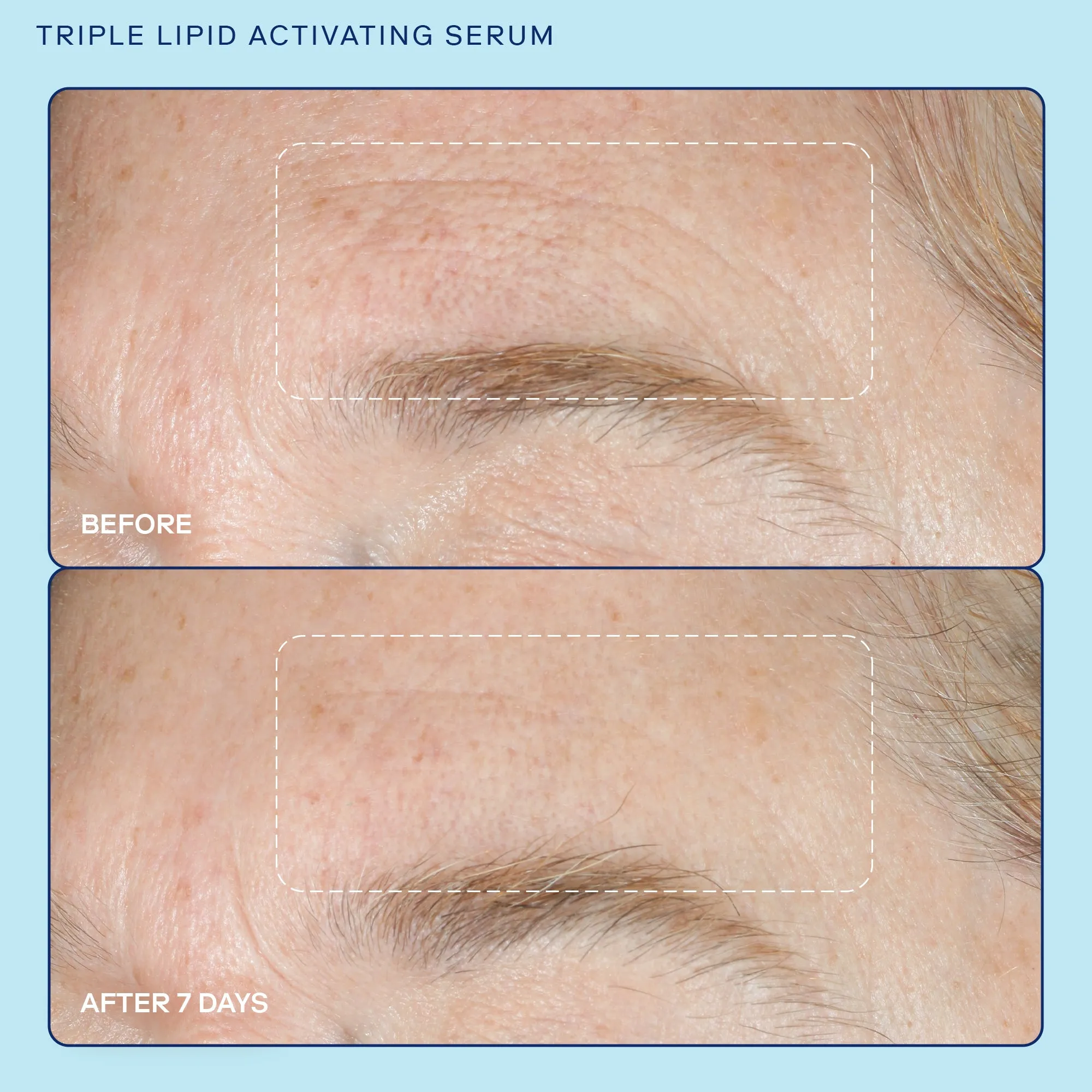 Barrier  Triple Lipid Activating Serum