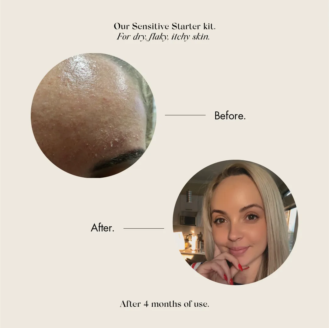 BASIC 4 SENSITIVE Travel Size