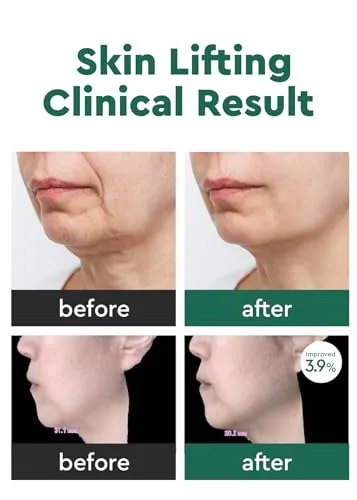 BE WANTS Bewants Neck Lifting & Firming Cream with Centella Asiatica | Vegan Hyaluronic Acid | Neck Firming Cream Tightening Lifting Sagging Skin with Gua Sha Roller | Korean Skincare | 1.7 fl oz