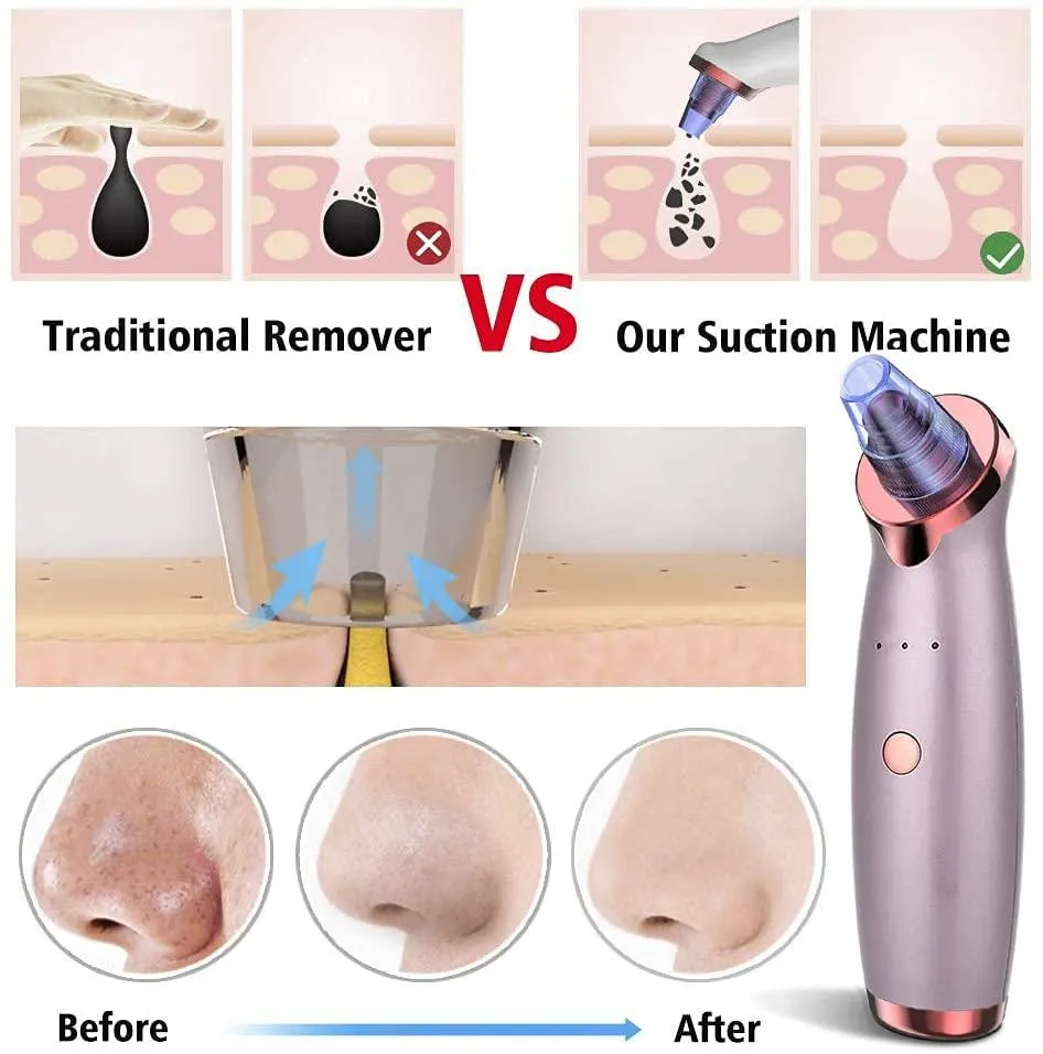 Blackhead Pore Vacuum Cleaner Remover, Facial Pore Cleaner Electric with 2 in 1