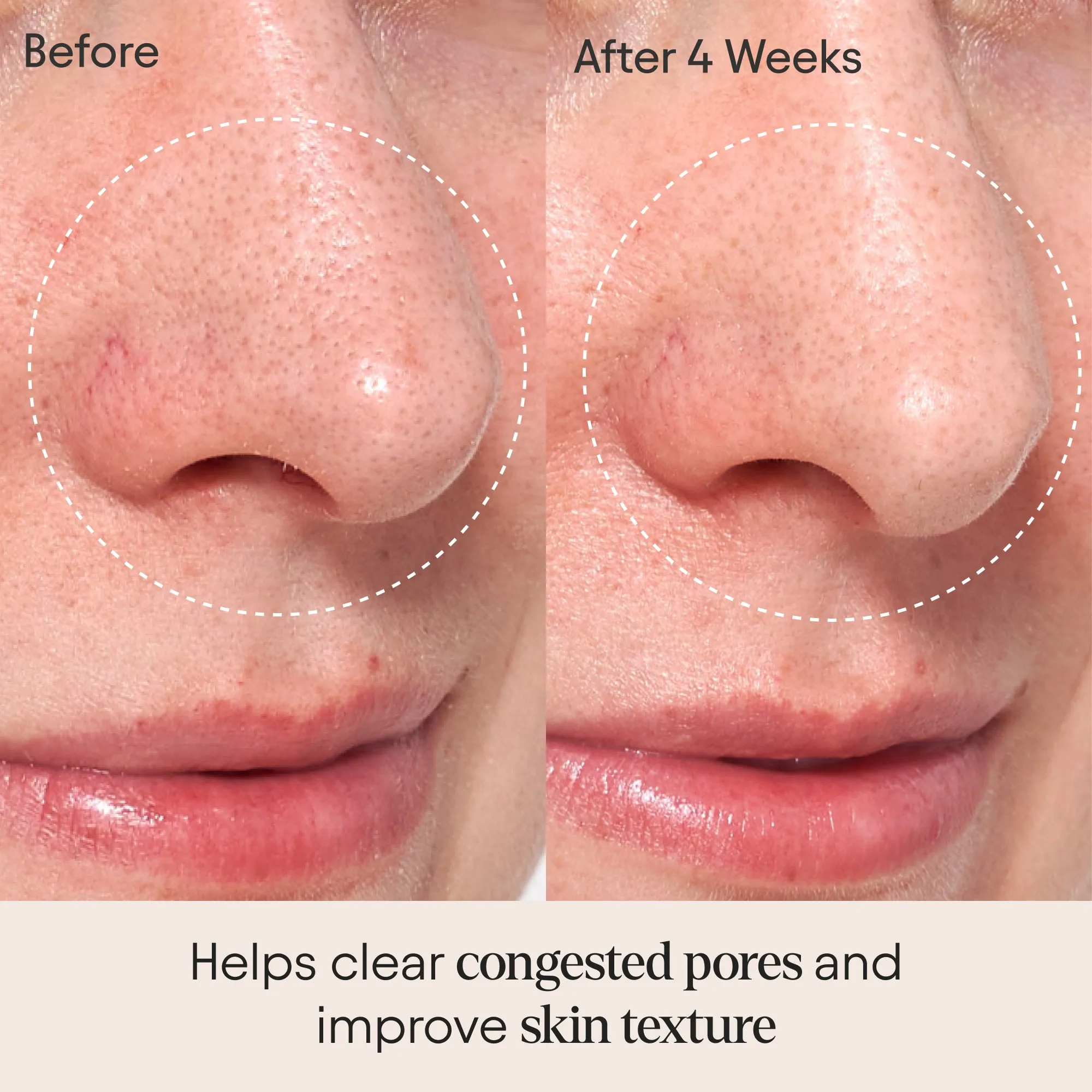 Clarifying Facial Oil