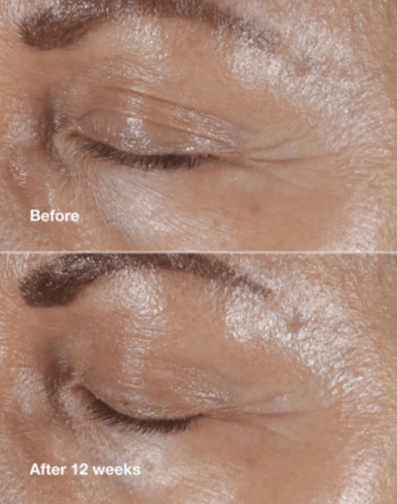 CLINIQUE gift بكج مفضلات كلينيك الاعلى مبيعاً