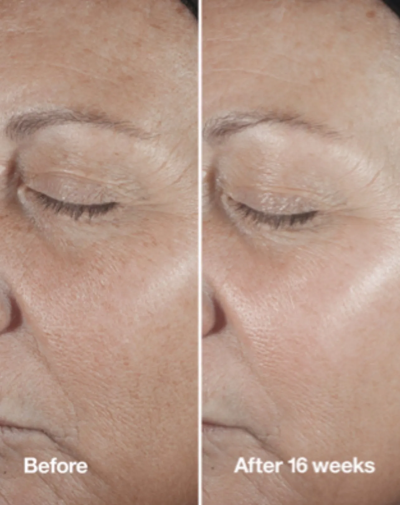 CLINIQUE gift بكج مفضلات كلينيك الاعلى مبيعاً