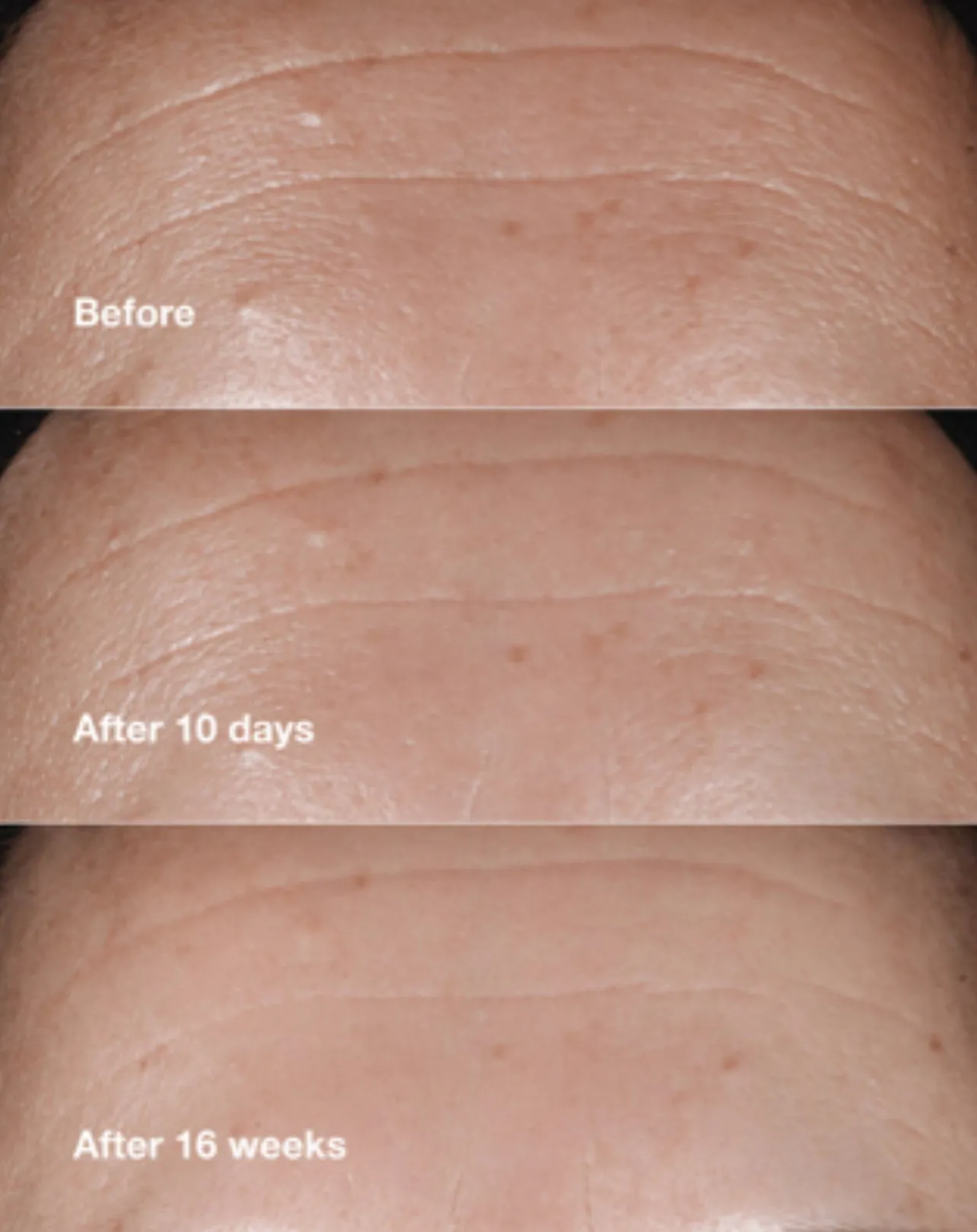 CLINIQUE gift بكج مفضلات كلينيك الاعلى مبيعاً