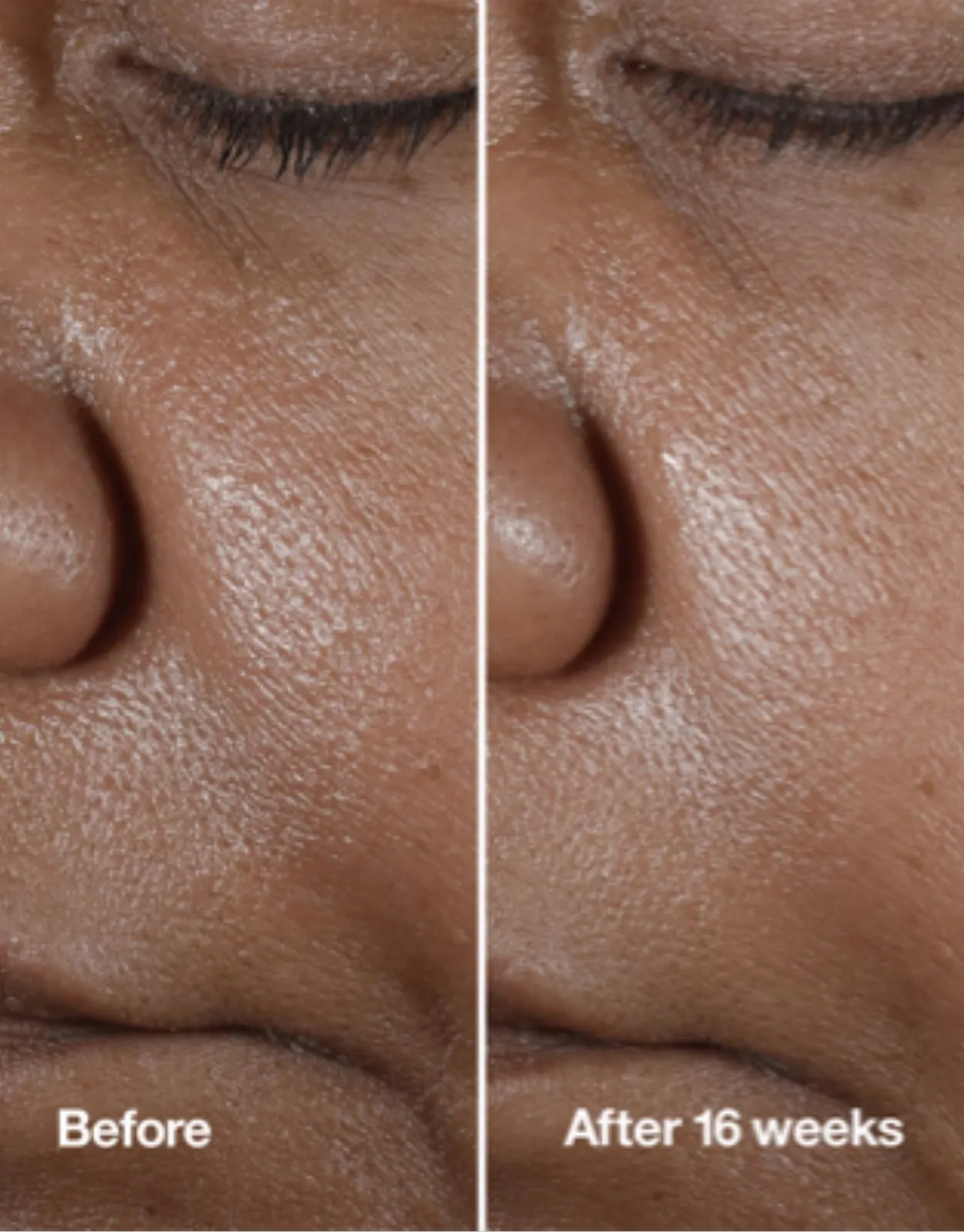 CLINIQUE gift بكج مفضلات كلينيك الاعلى مبيعاً