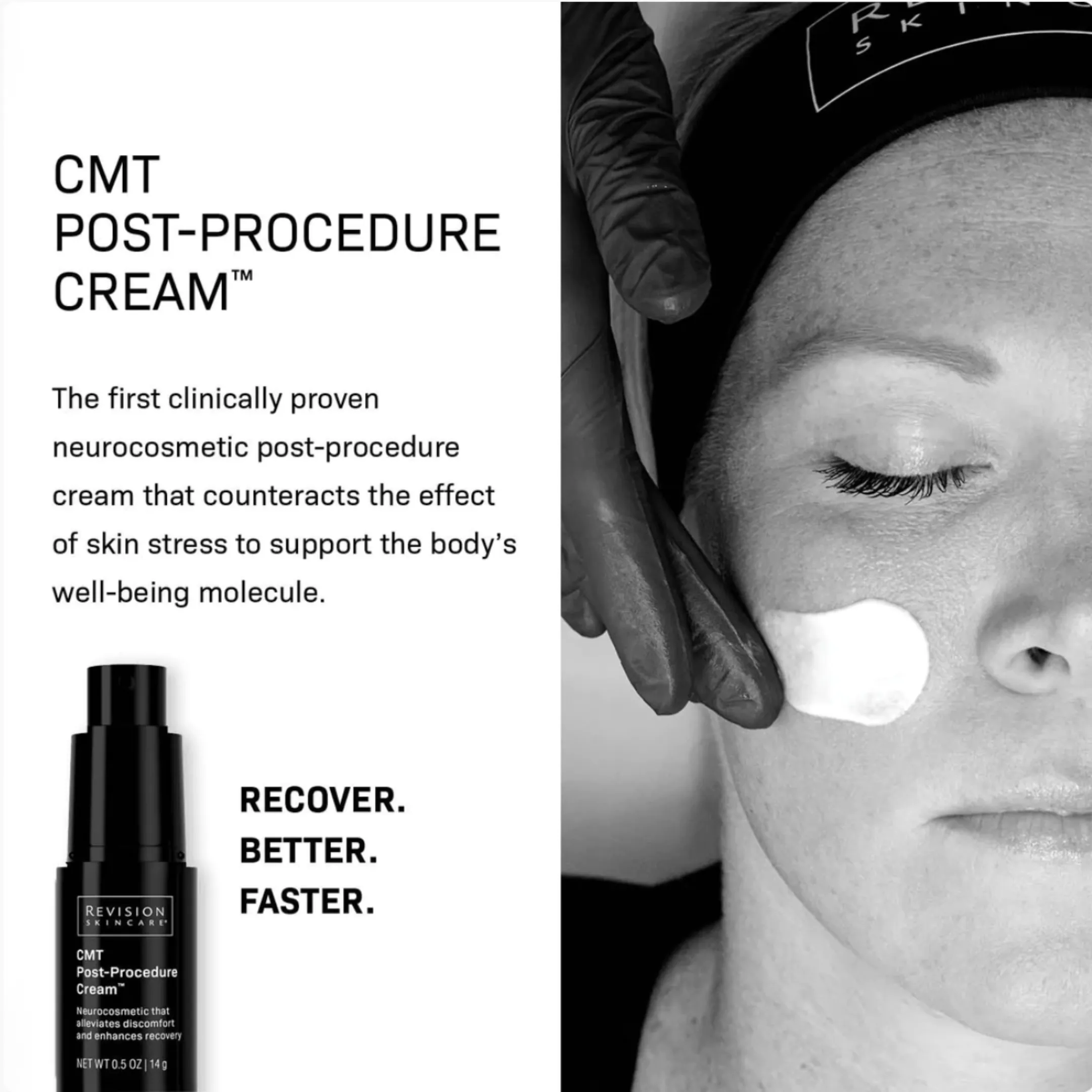 CMT Post-Procedure Cream
