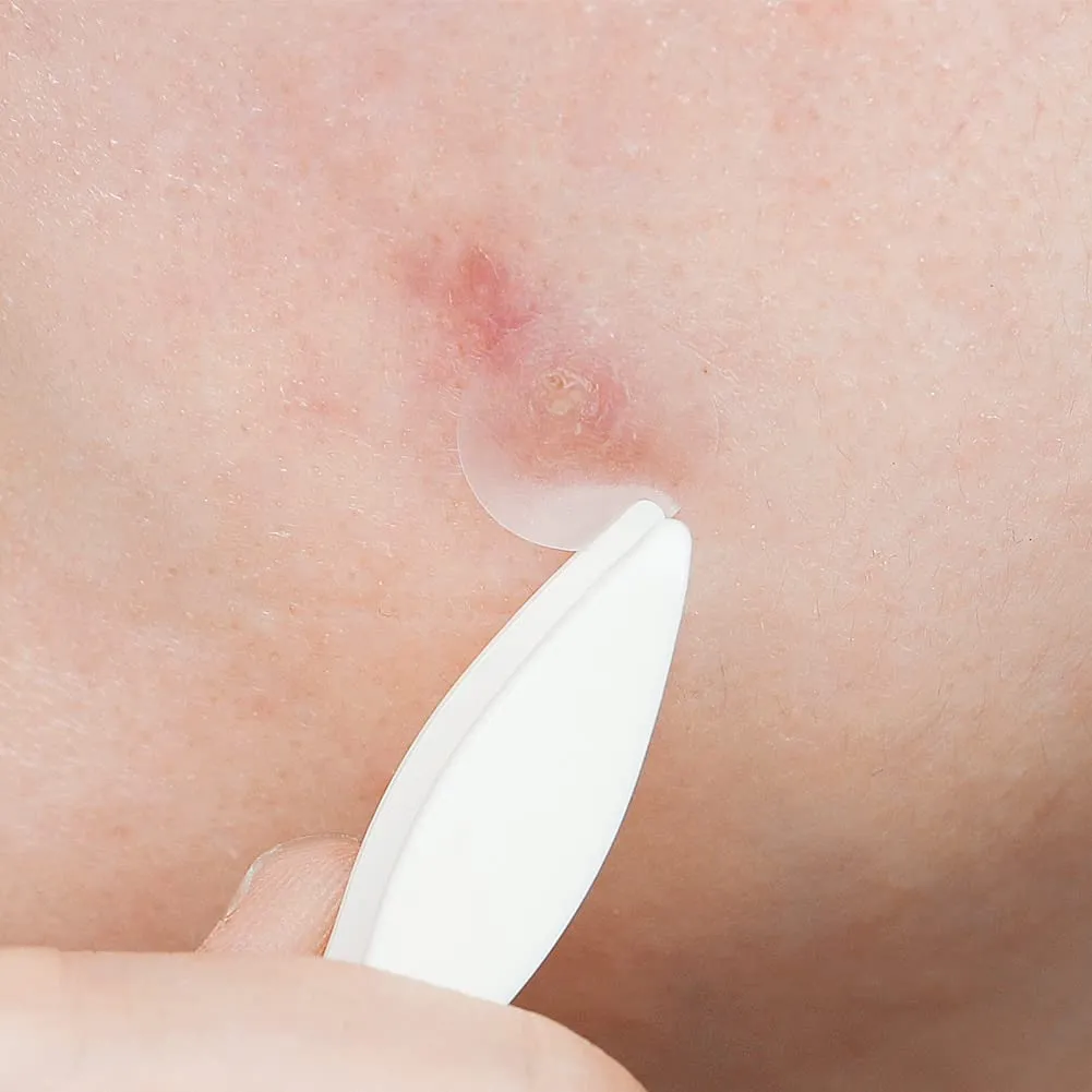 ELIZAVECCA ac guard spot patch لصقات تهدئة التهيج من اليزافيكا