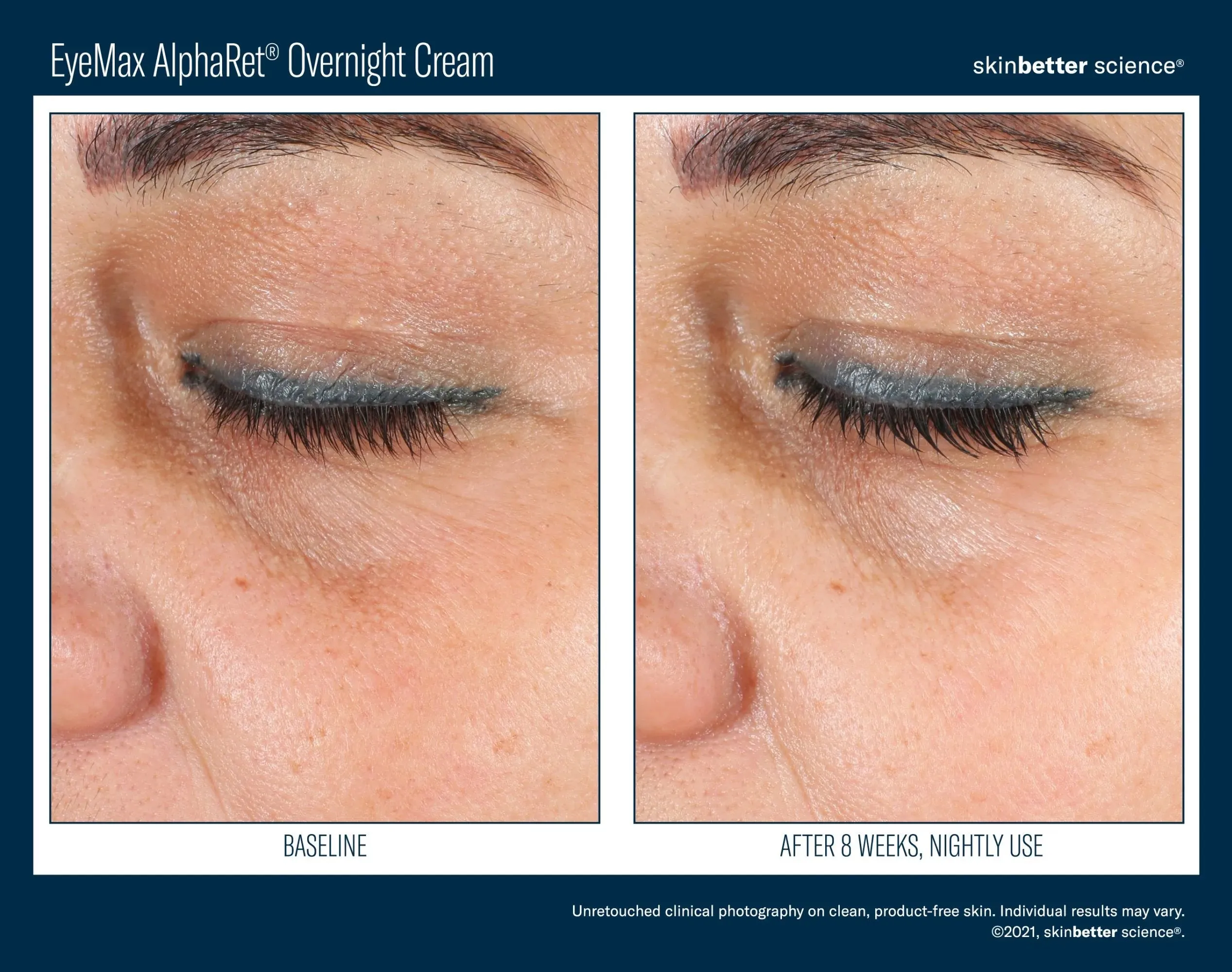 EyeMax AlphaRet Overnight Cream