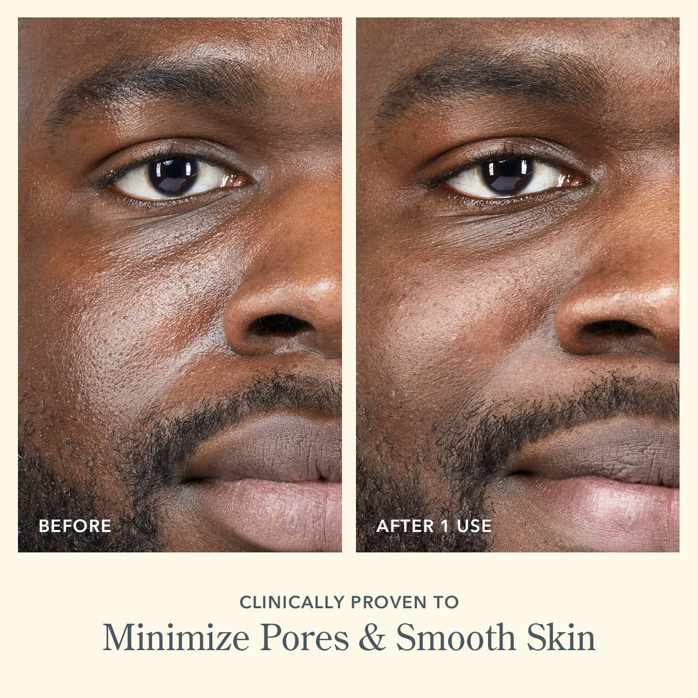 Forever Young Skincare Set