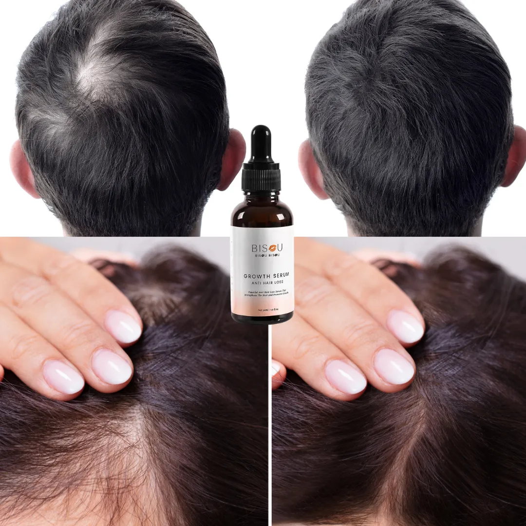 Hair Growth Serum