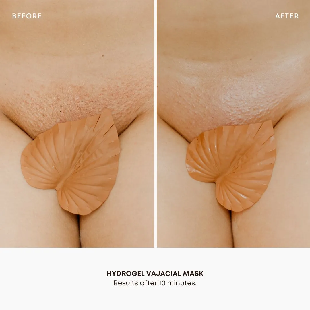 Hydrogel Vajacial Side Strips