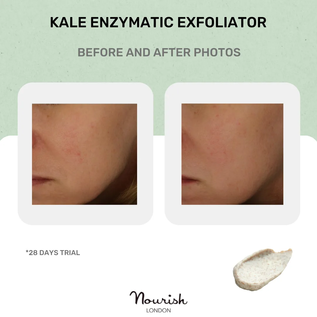 Kale Enzyme Exfoliator