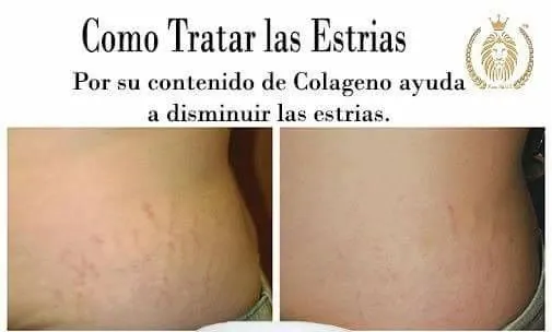 Karinalily Slimming Gel with Collagen (Gel Reductor) (Tummy Gel) Pomada