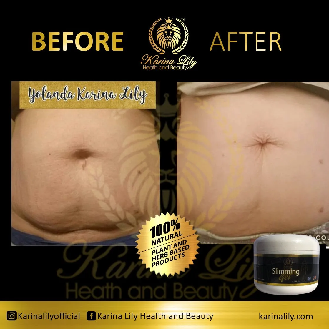 Karinalily Slimming Gel with Collagen (Gel Reductor) (Tummy Gel) Pomada