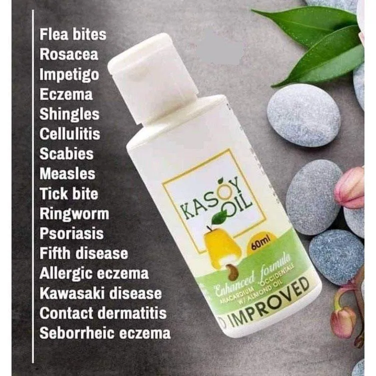 Kasoy Oil & Cream (Combo)