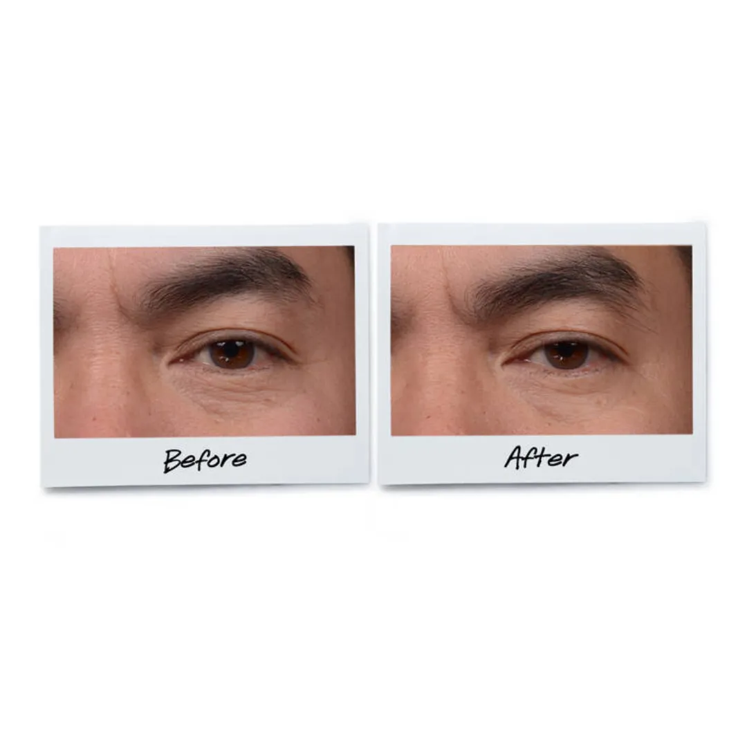 Kiehl's Age Defender Eye Repair 14ml