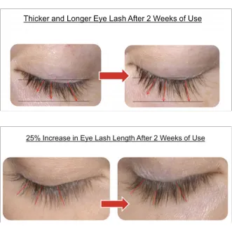 LAshX ProLine Lash Serum and Eyeliner In One