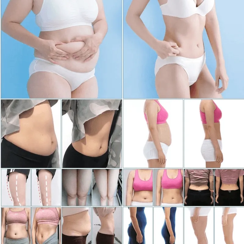 Lishou Slimming Cream Accelerates Fat Burning - 200ml