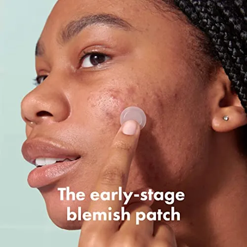 Mighty Patch Micropoint for Blemishes from Hero Cosmetics - Hydrocolloid Acne Spot Treatment Patch for Early Stage Zits and Hidden Pimples, 395 Proprietary Micropoints (8 Patches)