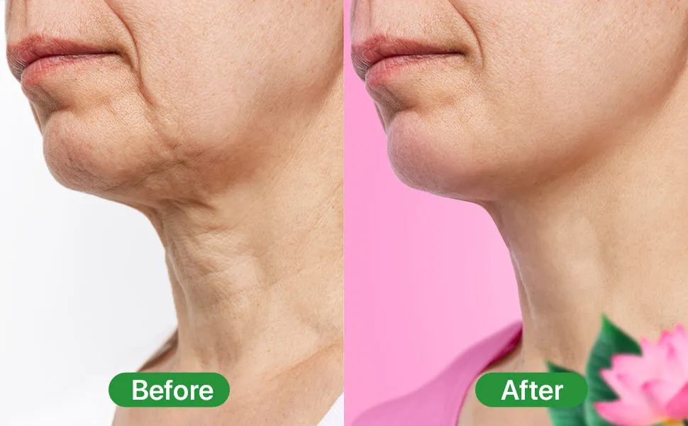 Neck Firming Cream, Tightening Lifting Sagging Skin with Retinol & Collagen