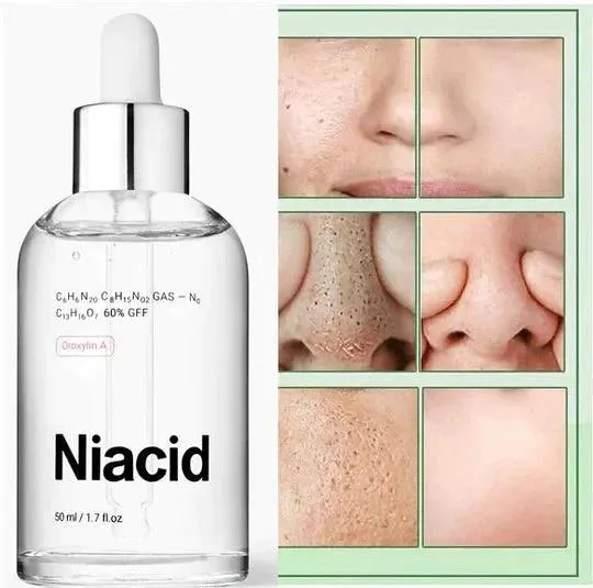 Niacid Serum 30 ml ( Pack of 2 )
