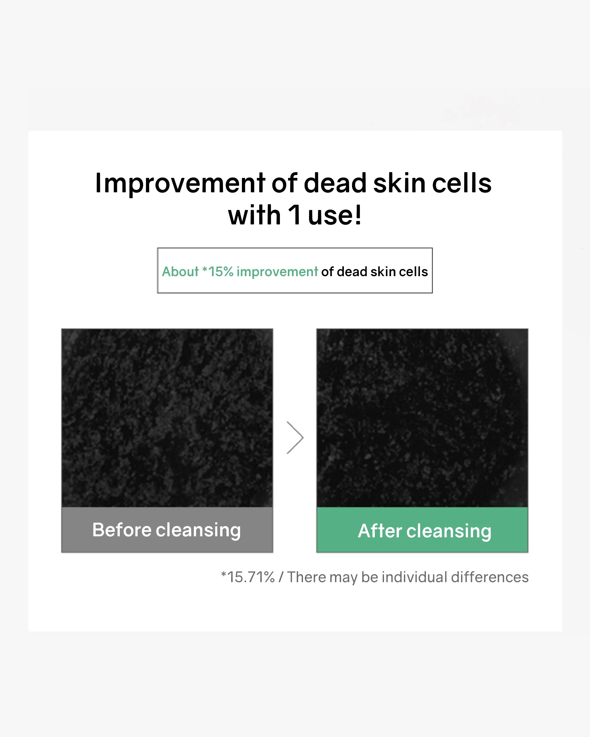 [PROMO] Bonabella Teatree Moist Soothing Cleanser