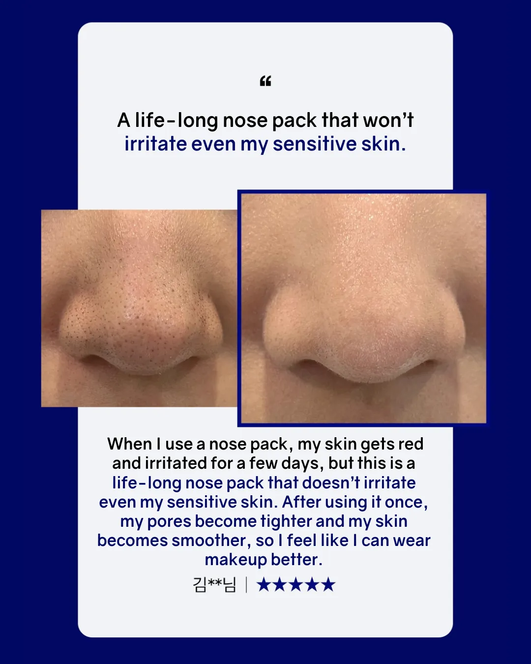 [PROMO] MEDIHEAL Black Head Melting Clear Nose Patch - NEW!