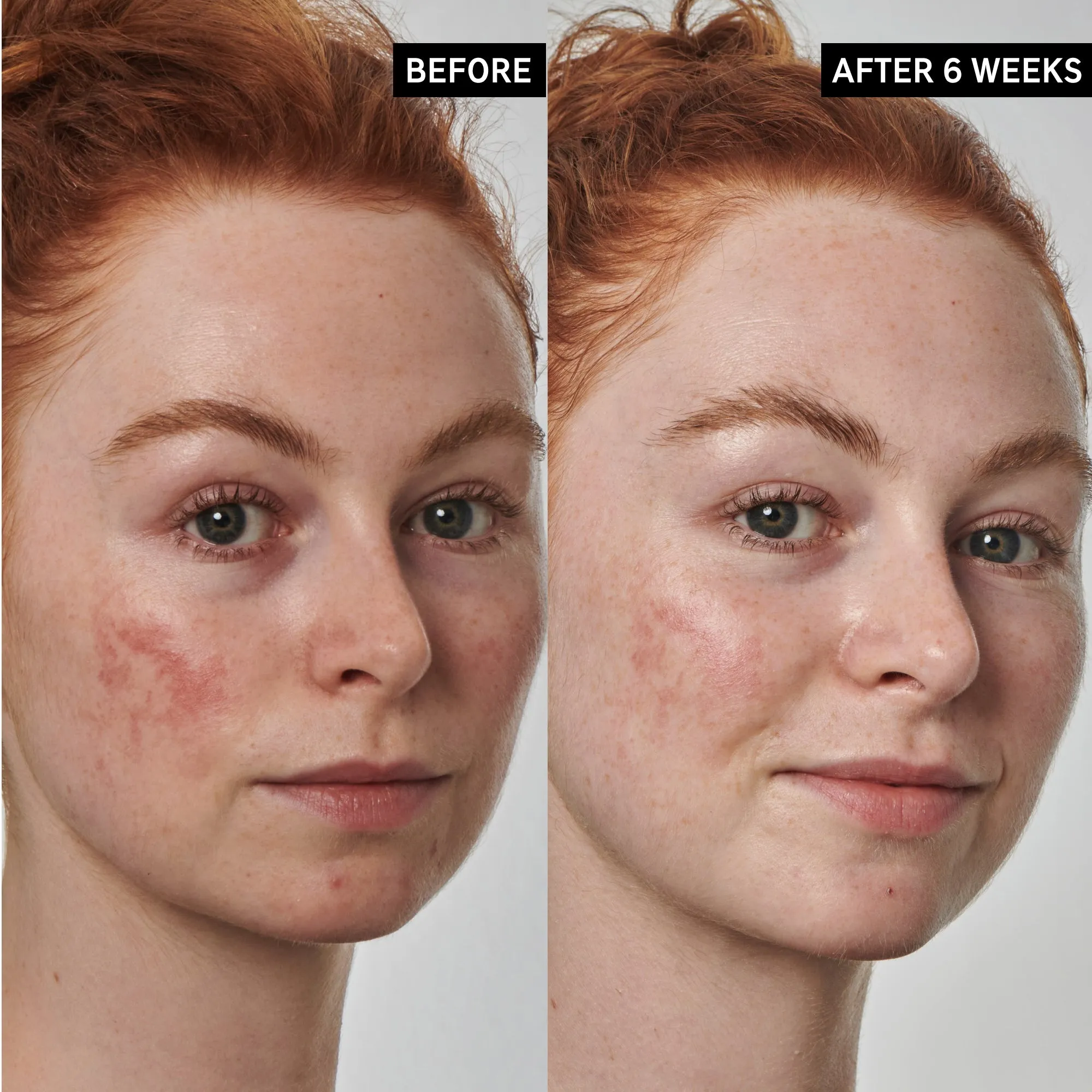 Redness Relief Solution