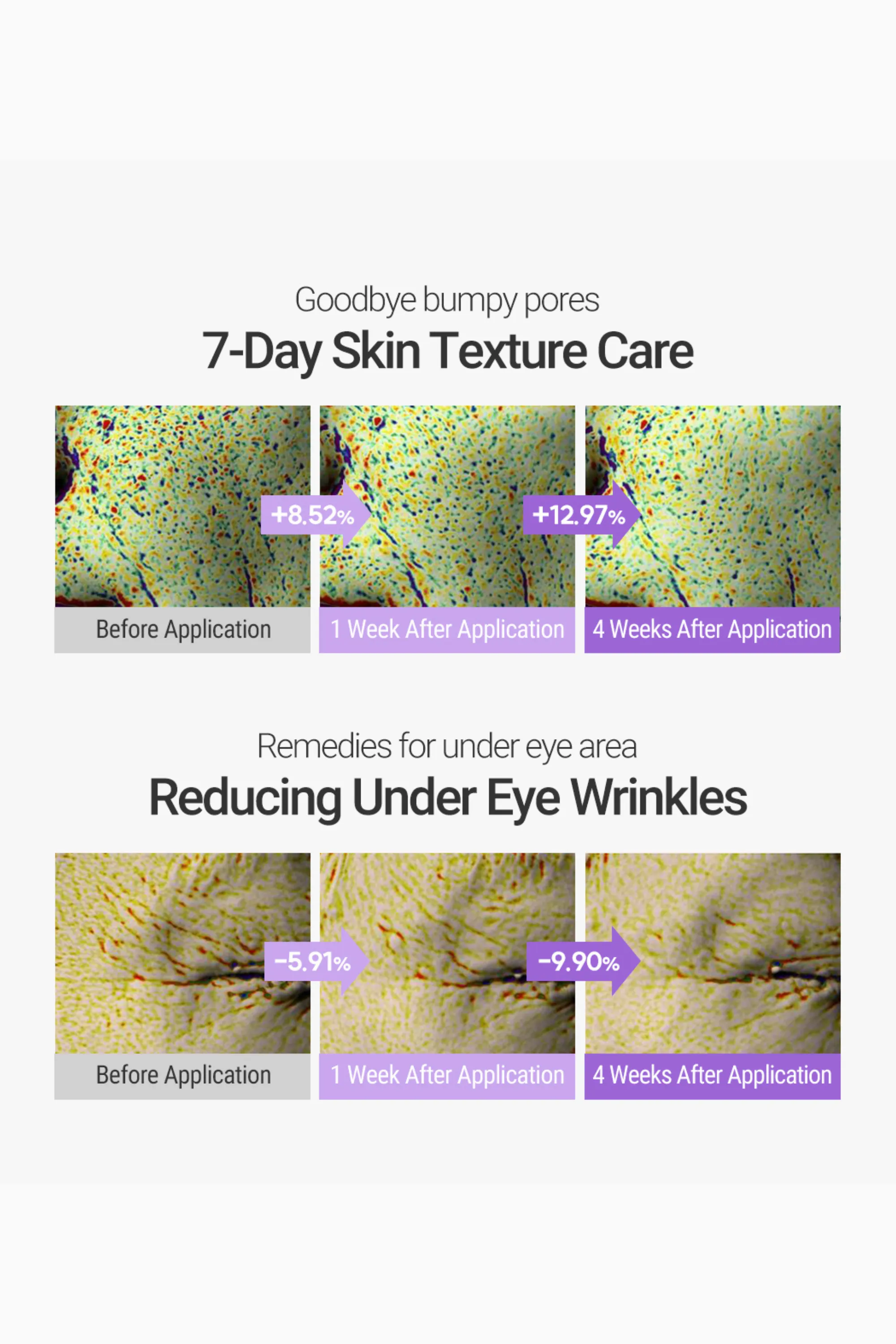 Retinosine Deep Intense Cream & Aqua Hyaluronic Essence