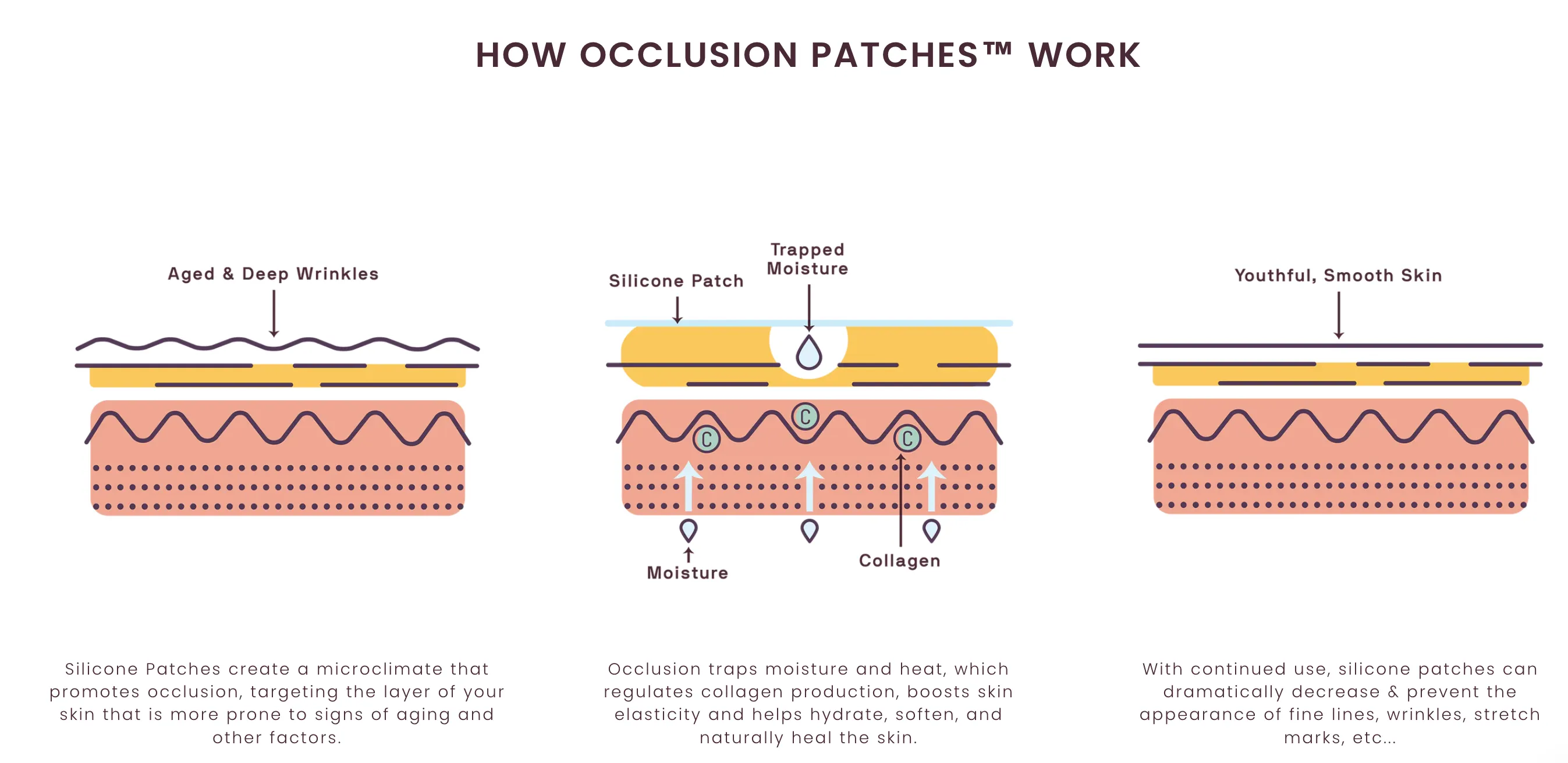 SILICONEFUSION™ Forehead Patch