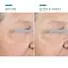 Skinceuticals A.G.E. Advanced Eye For Dark Circles