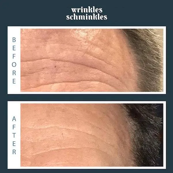 Wrinkles Schminkles Men's Forehead Smoothing Kit